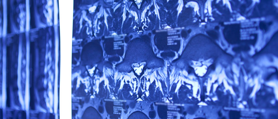 Medical Imaging - MRI images of the Brain